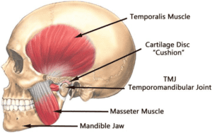 tmj image 300x188 - Do You Have Jaw Pain? You might have a TMJ Disorder