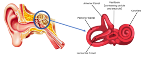 vestibular mid 300x122 - Treatment for Dizziness at All Care Physiotherapy - Vestibular Neuritis