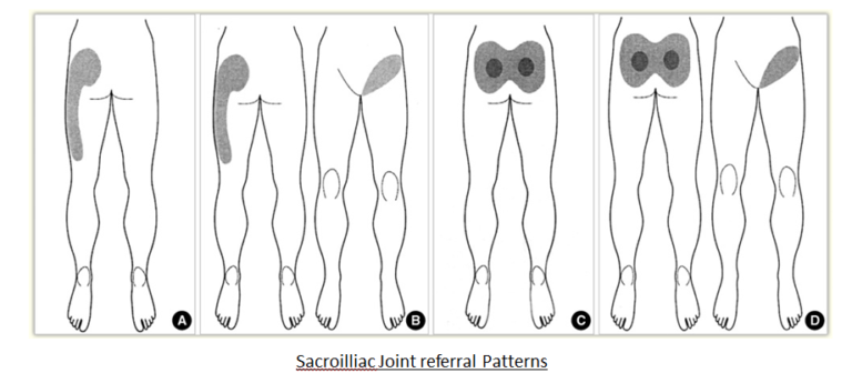 pelvic-pain-all-care-physiotherapy